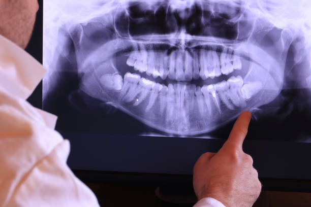 Best Emergency Root Canal Treatment in Marlow Heights, MD